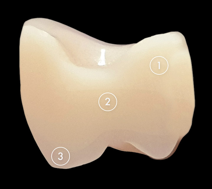 Анис эксперт четырехслойные зубы C3